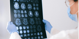 Researcher looking at brain scans