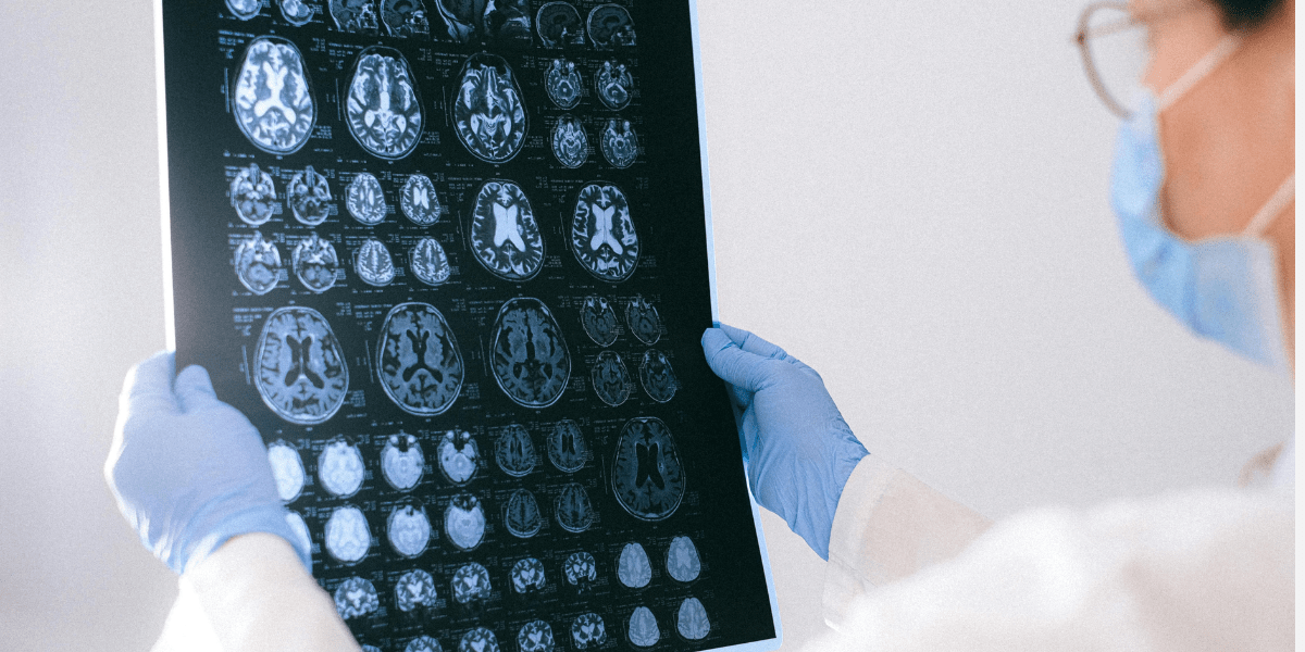 Researcher looking at brain scans